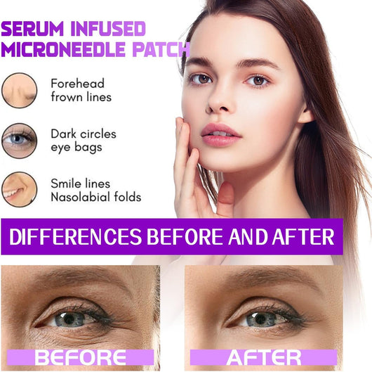 MicroGlow Patches by NOVA LIFT