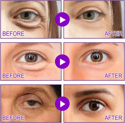 MicroGlow Patches by NOVA LIFT