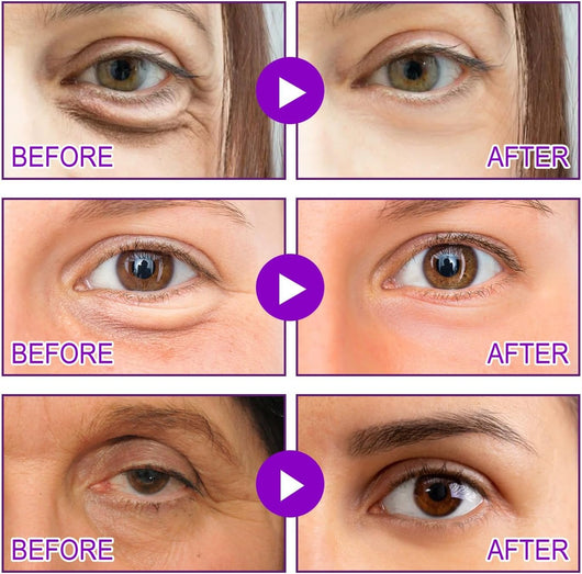 MicroGlow Patches by NOVA LIFT